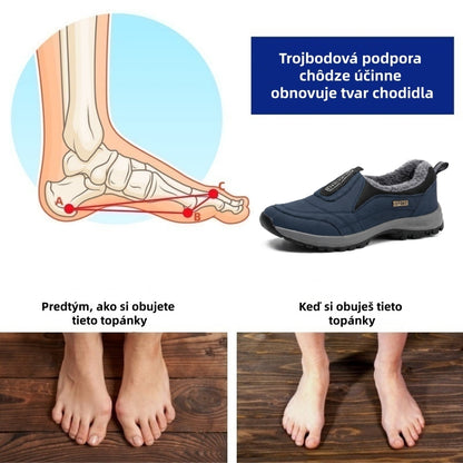 🎉Dnešná špeciálna ponuka: Zľava 70 % – Nenechajte si to ujsť! ⏰Ergonomická zimná ortopedická obuv na úľavu od bolesti chodidiel, kolien a chrbta – unisex