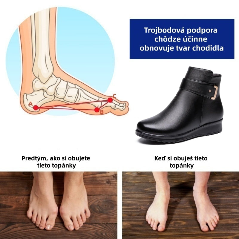 Ultimo giorno! Sconto del 70%! ✅ Scarpe ortopediche da donna, realizzate in pregiata pelle italiana, alleviano il dolore alla schiena, alle articolazioni e ai piedi.