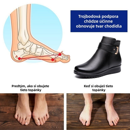 Ultimo giorno! Sconto del 70%! ✅ Scarpe ortopediche da donna, realizzate in pregiata pelle italiana, alleviano il dolore alla schiena, alle articolazioni e ai piedi.