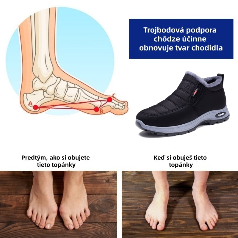 🎉Dnešná špeciálna ponuka: Zľava 70 % – Nenechajte si to ujsť! ⏰Ergonomická zimná ortopedická obuv na úľavu od bolesti chodidiel, kolien a chrbta – unisex