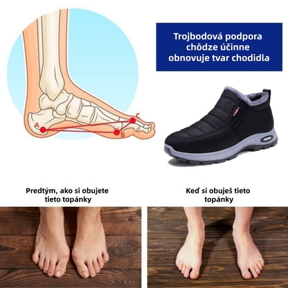 🎉Dnešná špeciálna ponuka: Zľava 70 % – Nenechajte si to ujsť! ⏰Ergonomická zimná ortopedická obuv na úľavu od bolesti chodidiel, kolien a chrbta – unisex